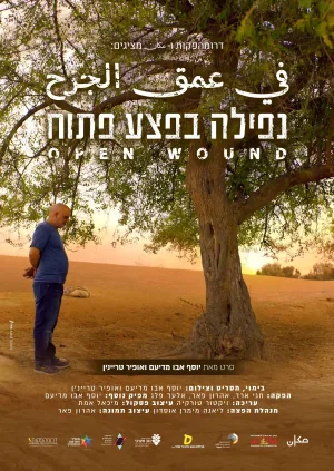 زخم باز